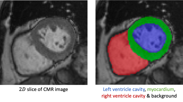 LVSegmenter: Left Ventricle Segmentation